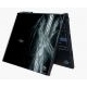 Skin Laptop