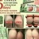 HEEL BALM - KRIM PENGHALUS TELAPAK KAKI